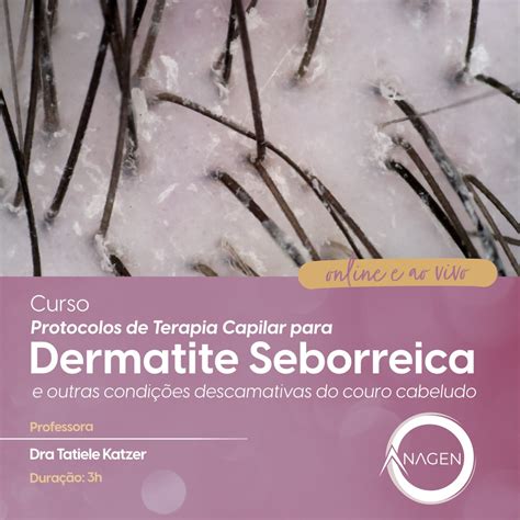 Terapia Capilar para Dermatite Seborreica e outras condições