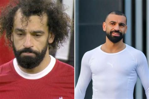 The Best And Worst Hair Transplants In Football History Dmarge