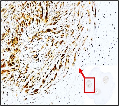 Cell Adhesion Infiltration Antibody Panel IRAP5022 IReal