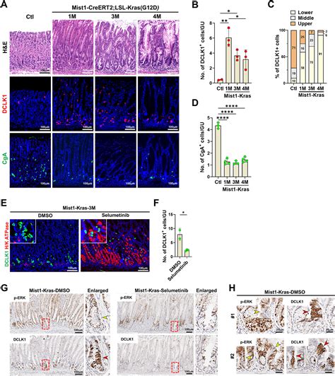 Dynamic Tuft Cell Expansion During Gastric Metaplasia And Dysplasia