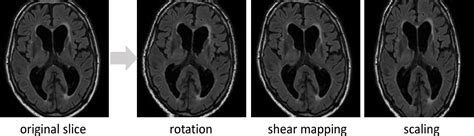 Pdf Fully Convolutional Network Ensembles For White Matter