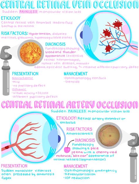 Aesthetic Medical Notes Central Retinal Vein Artery Occlusion