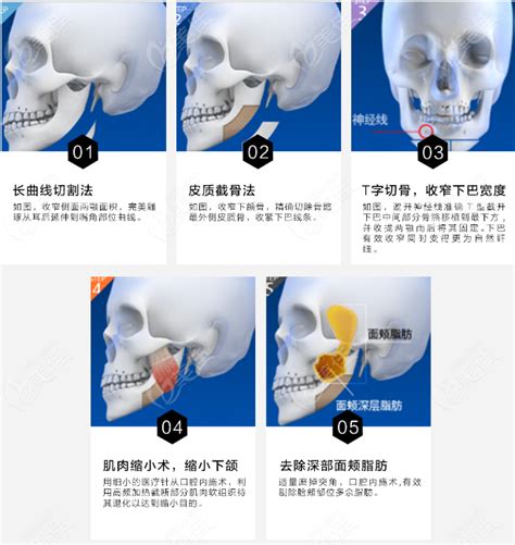 韩国必妩整形医院价格表 爱丽帮