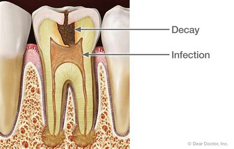 Tooth Pain | Northwest Dental | Glyndon Maryland