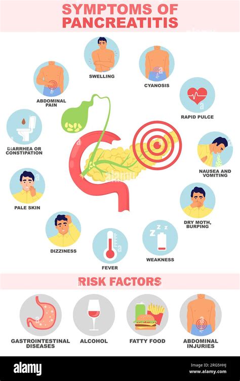 S Ntomas Y Factores De Riesgo De Pancreatitis Ilustraci N Vectorial