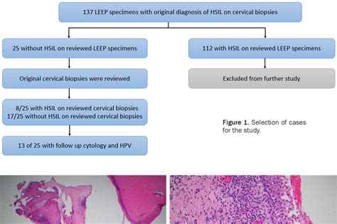 Figure 1 From Negative Loop Electrosurgical Excision Procedure Leep