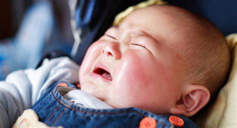 Meningitis in babies | BabyCenter