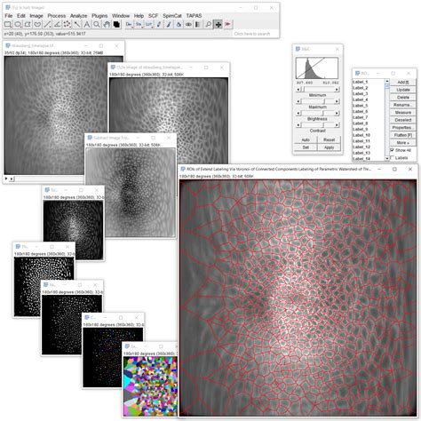 Cell Segmentation Based On Membrane Markers Assistant