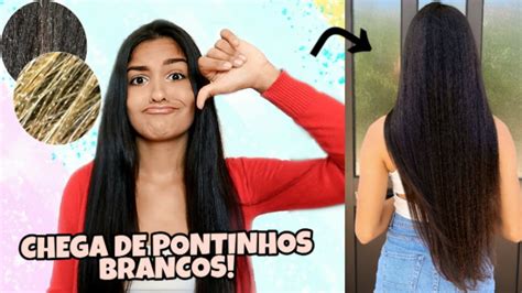 Como Se Livrar Dos Pontinhos Brancos No Cabelo Youtube