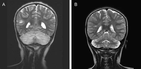 Resonancia Magnética Del Sistema Musculoesquelético Medimagen