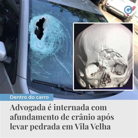 N O Foi Acidente On Twitter Ap S Ser Atingida Por Um Paralelep Pedo