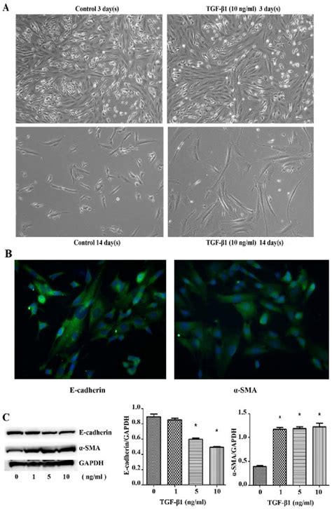 Cell Morphology Changes And E Cadherin Sma Was Expressed In Sk N Sh