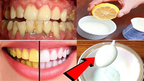 Teeth Whitening At Home Baking Soda Whitening Toothpaste That