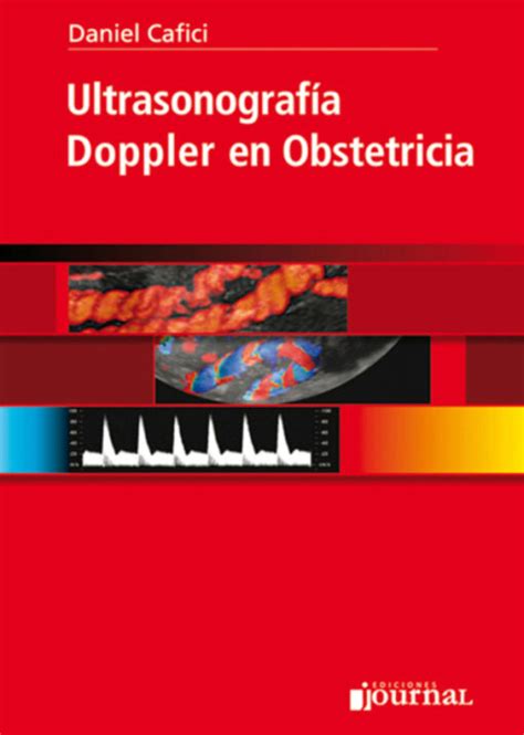 Ultrasonografía Doppler en Obstetricia eBook AlleText