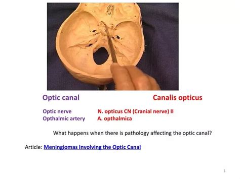 PPT - Optic canal Canalis opticus PowerPoint Presentation, free ...