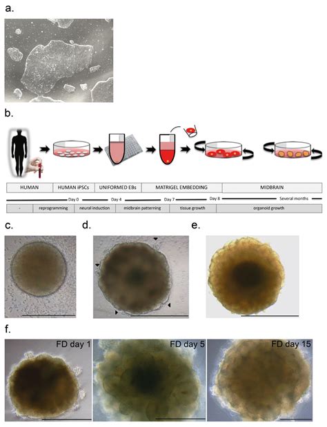 Generation Of Human Midbrain Organoids From MNI Open Research