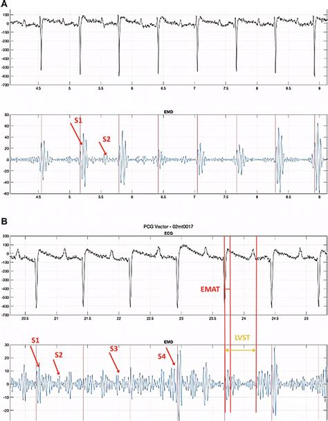 Jacc Journals On Twitter Interesting Report From Jaeson Bang On A