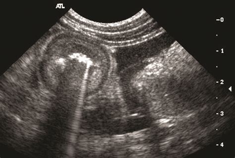 Physical Principles Of Abdominal Ultrasonography Part 1 Basics Of