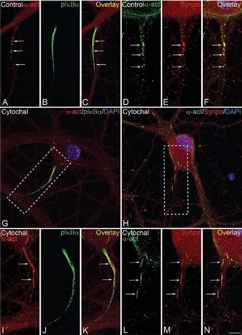 Figure 1 from Colocalization of α actinin and synaptopodin in the