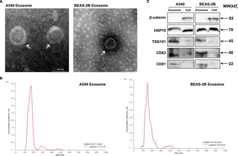 Frontiers Exosomes Of A549 Cells Induced Migration Invasion And Emt