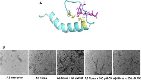 Frontiers Ginsenoside Compound K Reduces Neuronal Damage And Improves