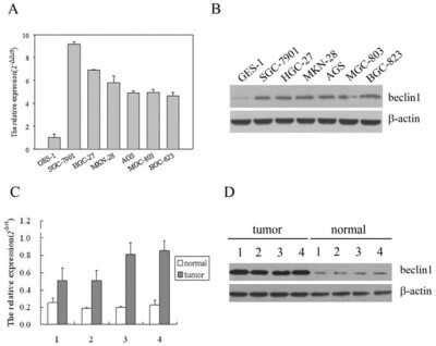 Beclin 1 Antibody BSA Free NB500 249 By Novus Part Of Bio Techne