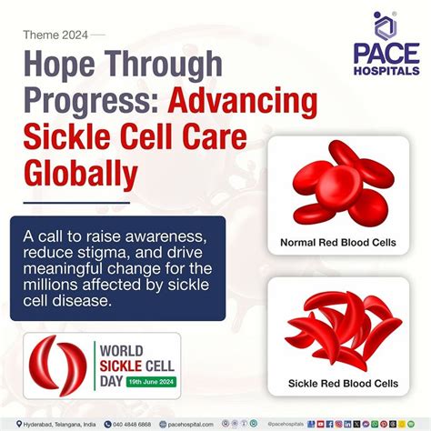 World Sickle Cell Day June Theme Importance History