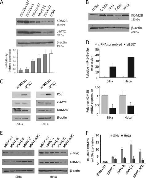 Kdm2b Expression In Hpv Positive Keratinocytes And Cervical Cancer Cell Download Scientific