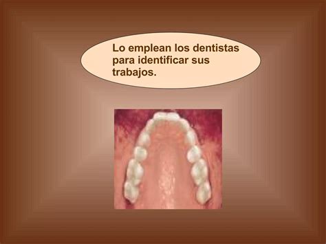 M Todos De Identificaci N Odontografica Ppt