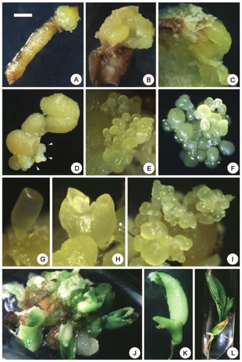 Callus Induction Somatic Embryogenesis And Plant Regeneration Of Areca