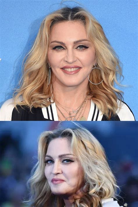 Madonna's Stunning Transformation: Before and After Plastic Surgery