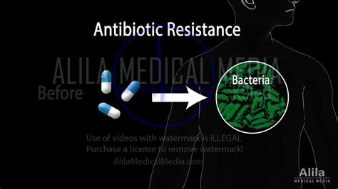 Alila Medical Media Antiviral Drugs Mechanisms Of Action Narrated