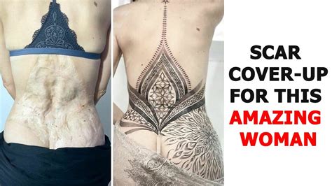 Times Tattoo Artists Made Incredible Scar And Birthmark Cover Up