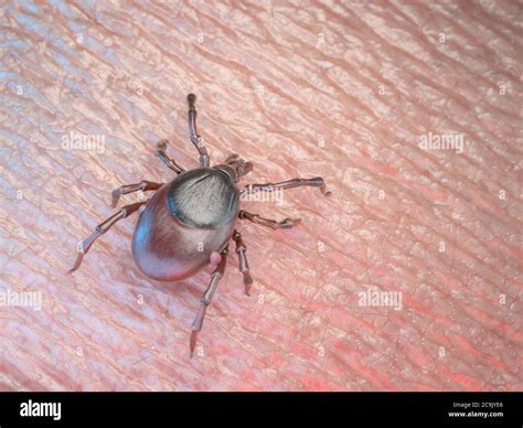 Tick On Human Skin Computer Illustration Stock Photo Alamy