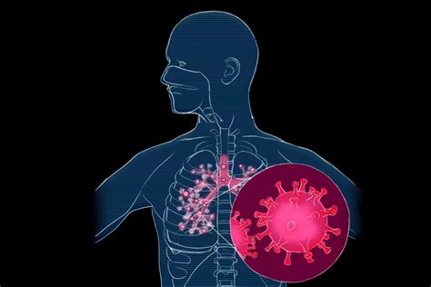 Veja O Que Se Sabe Sobre O Ataque Do Coronav Rus Ao Corpo Humano