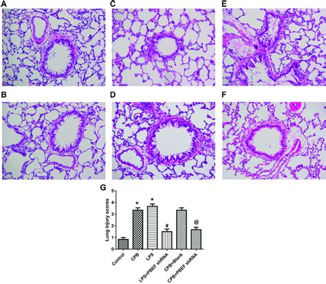 Pathological changes of lung tissue. HE staining was applied to detect ...