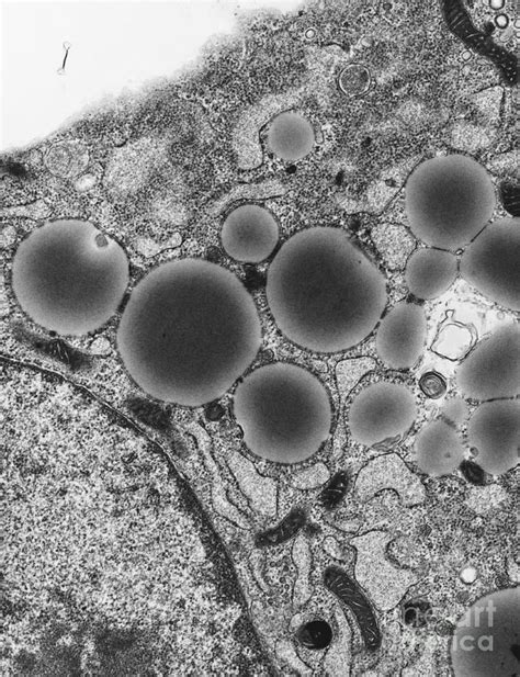 Lipid Droplet Staining