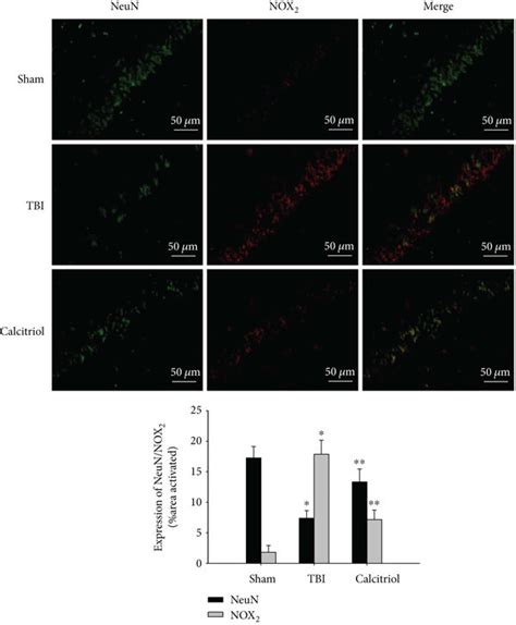 Double Immunofluorescent Staining Of NOX2 And NeuN Representative