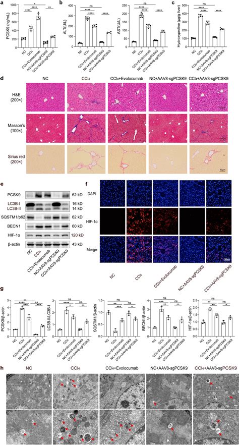 Hepatic Function Pcsk Expression And Autophagy In The Liver Of