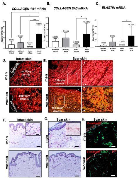 Extracellular Matrix Ecm Components In Intact Or Scar Tissues