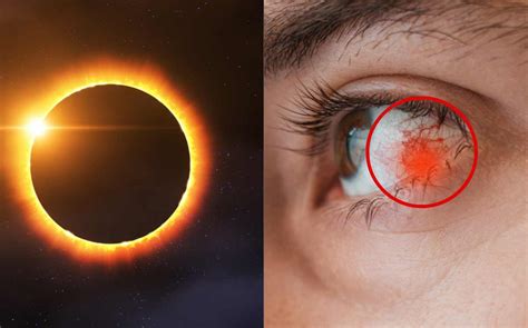 ¿qué Pasa Si Ves El Eclipse Sin Protección 5 Señales Que Indican Que Algo Anda Mal Salud180