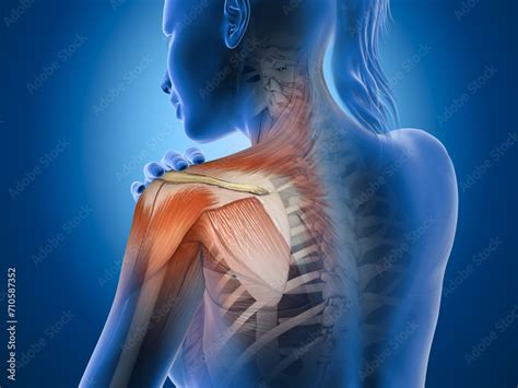 Painful Shoulder Joints Frozen Shoulder Impingement 3d Illustration