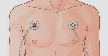 Performing Cardiac Monitoring ~ Nursing