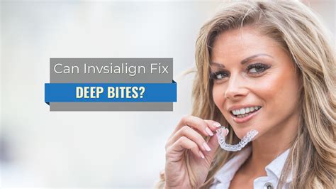 Can Invisalign Fix Deep Bites Premier Orthodontics