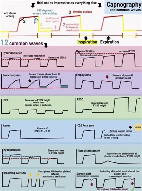 Pin by Susannah Norris on Reference | Nurse anesthesia, Emergency nursing, Anesthesia school