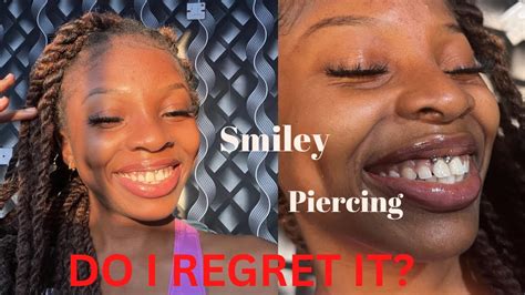 Removing My SMILEY Piercing After 4 Years What I Wish I Knew Pros