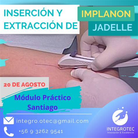 Inserción y Extracción de Implantes Subdérmicos Implanon Jadelle