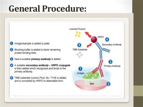 Elisa Ppt