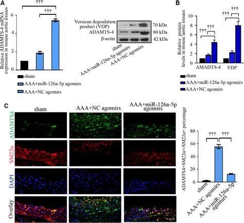 Adamts Expression Upregulates In Aortic Smcs Upon Ang Ii Infusion