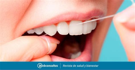 Consejos Para Prevenir El Sarro Dental Blog Dental Irriak